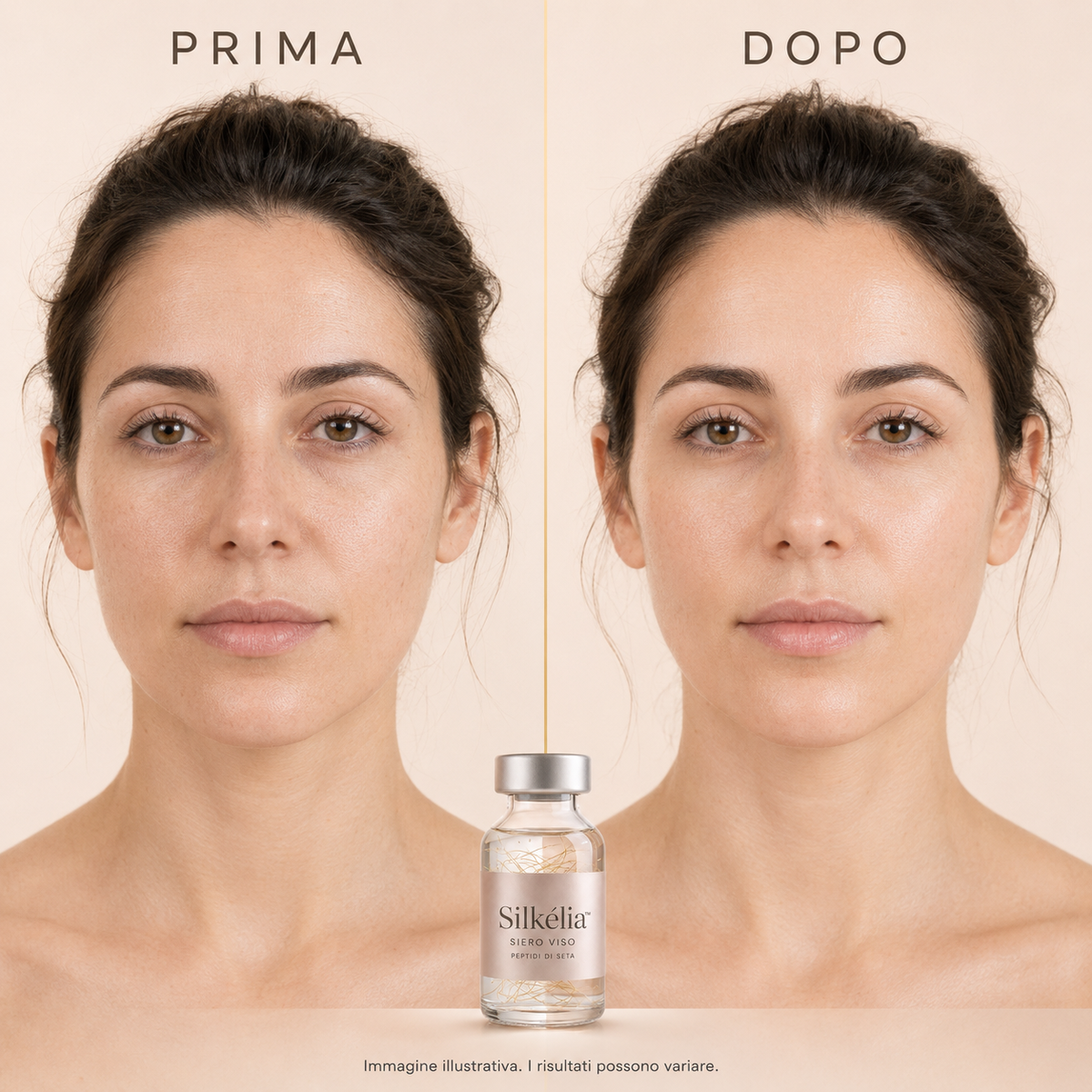 Risultato cosmetico illustrativo prima e dopo Silkélia
